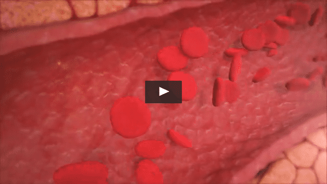 Exagen Diagnostics